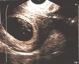ultrasound 4-20
